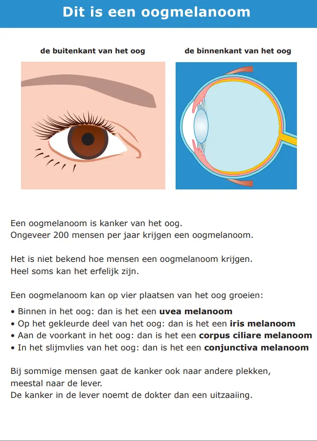 Praatkaarten oogmelanoom